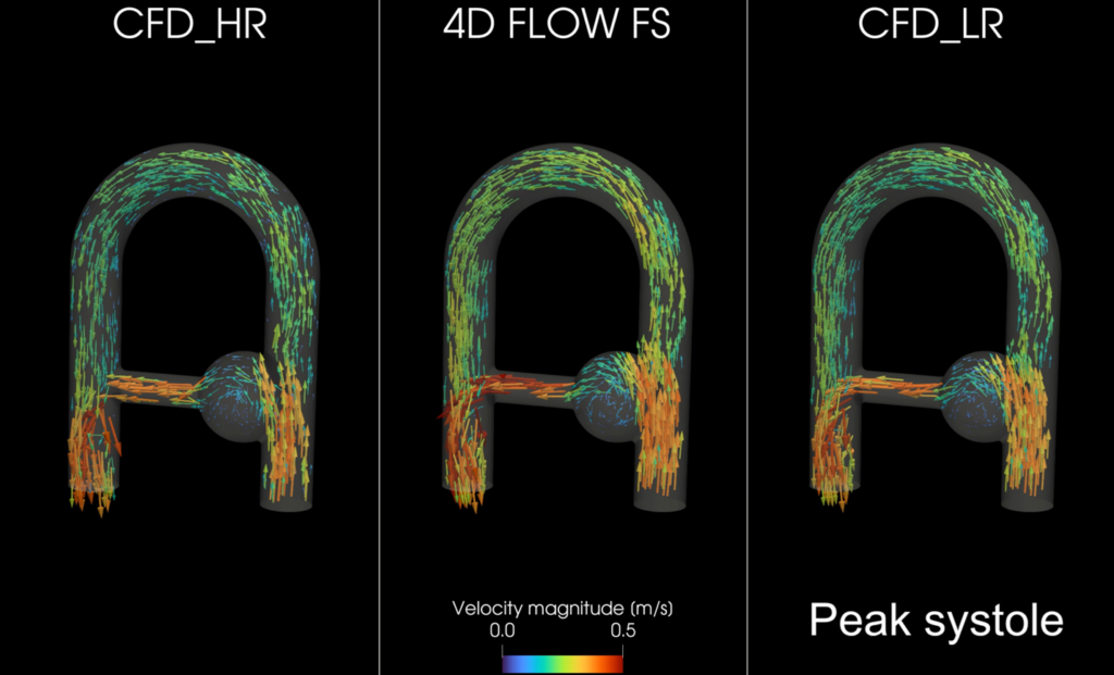« Accelerated sequences of 4D flow MRI 2