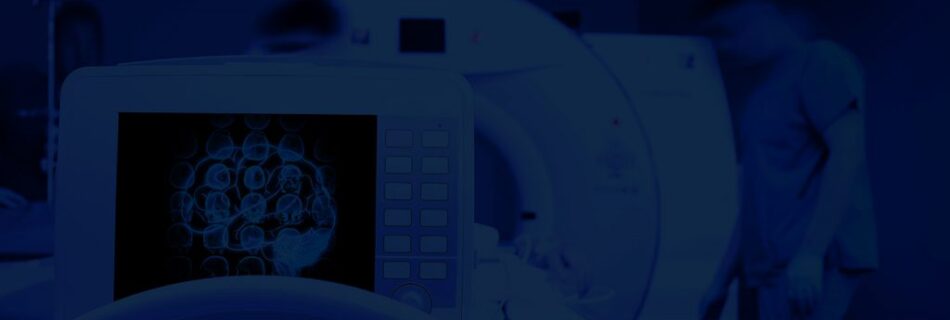 [PUBLICATION] The impact of acceleration factors in 4D flow MRI